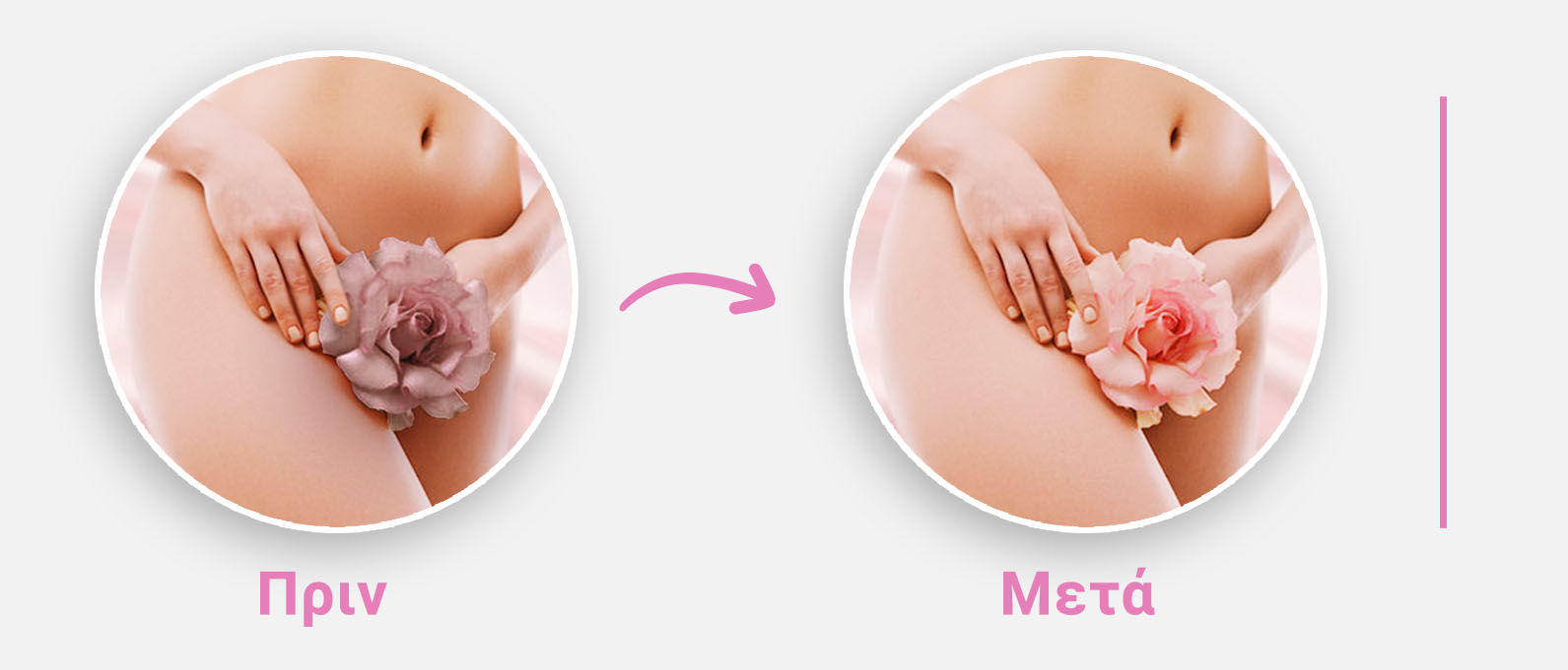 Pink Intimate Image3